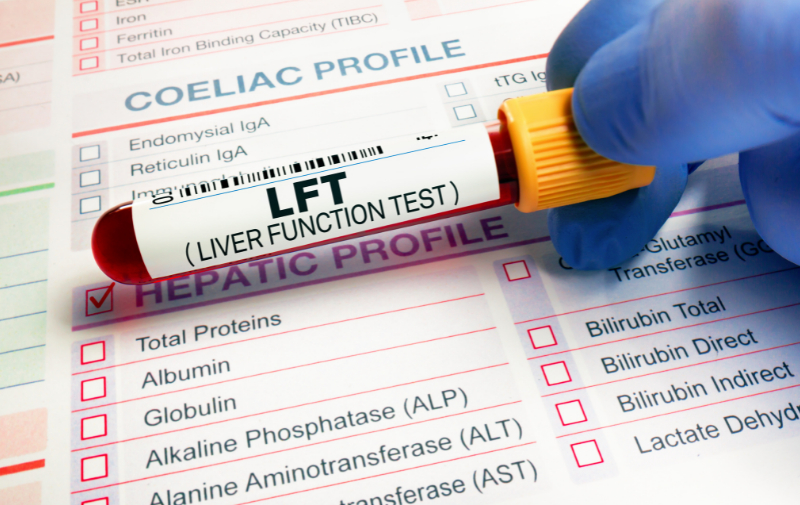 Strategic Cost Comparison of Liver Function Tests